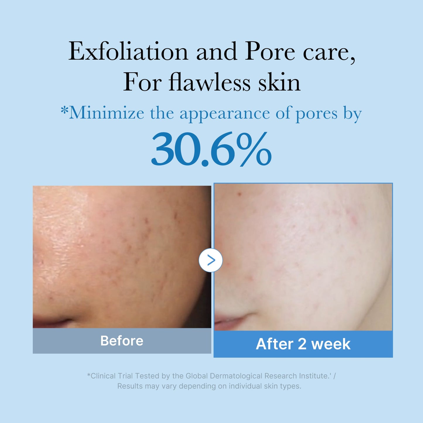 Medicube Zero Pore Toner bottle shown, clear container with label, designed for pore refining and skin refreshment.