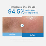 Zero Pore Blackhead Deep Cleansing Oil - SKINZA