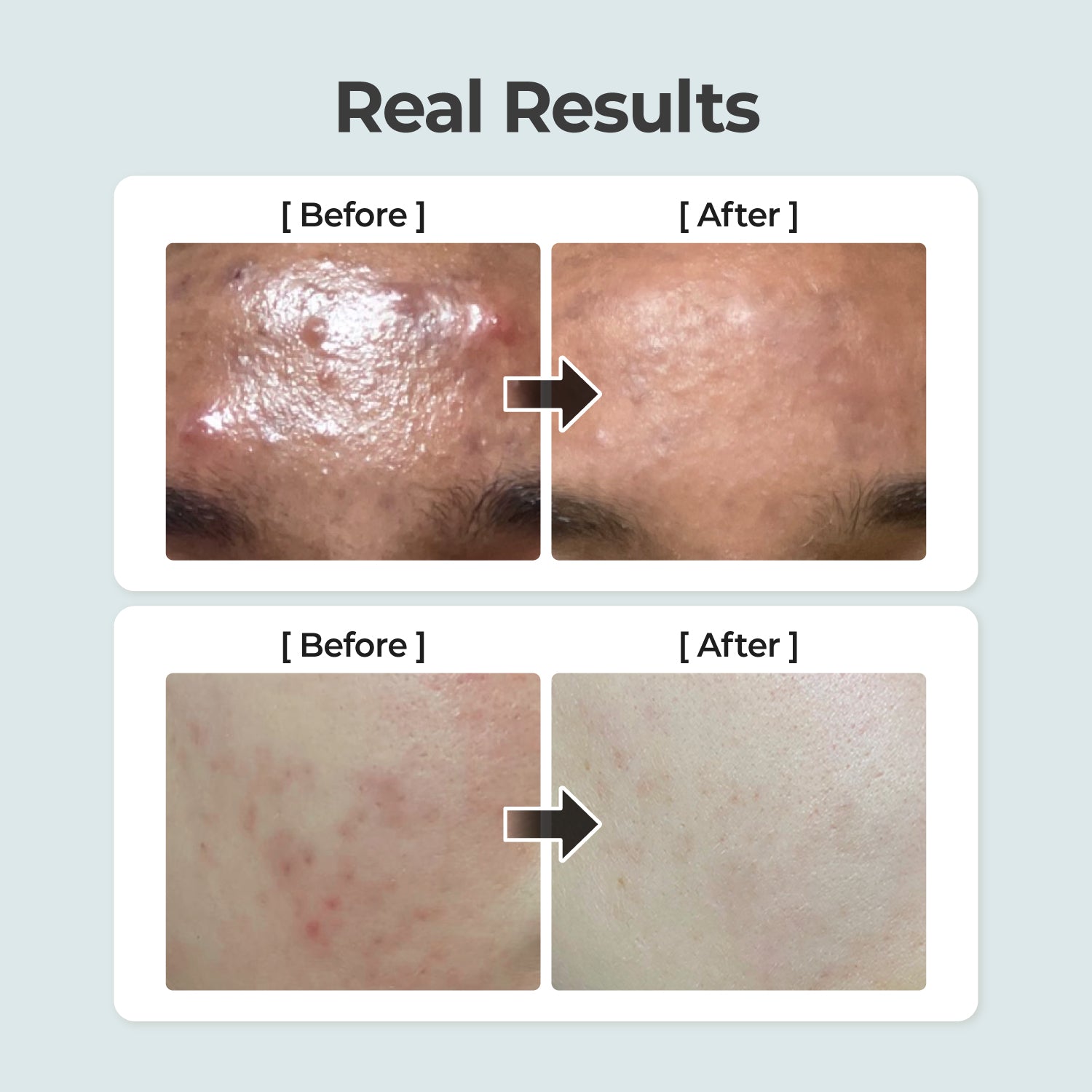 Numbuzin No.1 Pure-Full Calming Herb Toner bottle, natural herbal ingredients, designed for soothing and calming skin.