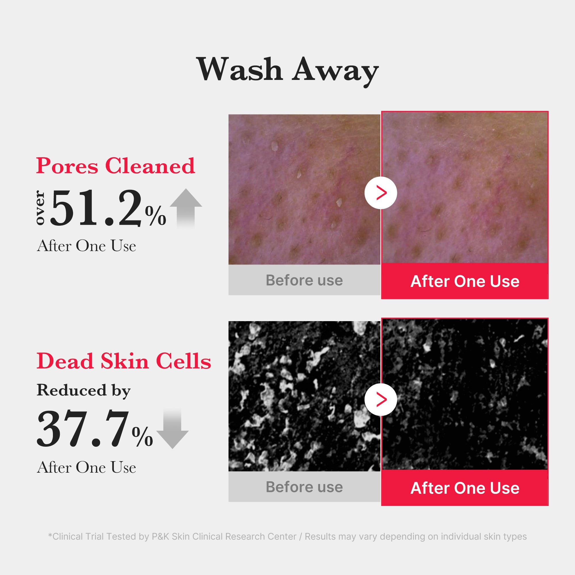 Red Foam Cleanser from RED LINE Acne Care by Shopify_ME, featuring a foaming facial cleanser in a vibrant red bottle.