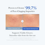Zero Pore Capsule Cleansing Foam from ZERO LINE pore care set, shown in a sleek white tube with blue accents.