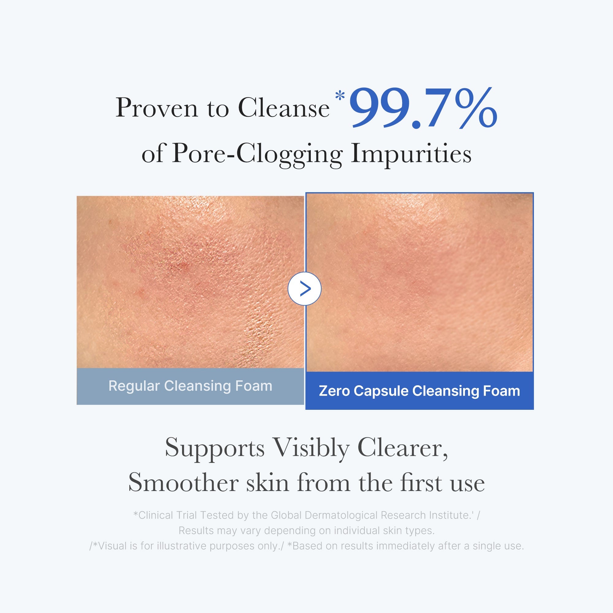 Zero Pore Capsule Cleansing Foam from ZERO LINE pore care set, shown in a sleek white tube with blue accents.