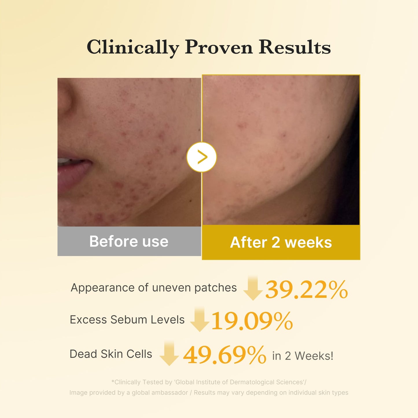 Medicube Kojic Acid Turmeric Face Pads for brightening and exfoliating skin, shown in a close-up image of the toner pads.