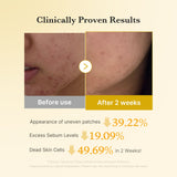 Medicube Kojic Acid Turmeric Face Pads for brightening and exfoliating skin, shown in a close-up image of the toner pads.