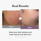 AGE-R Glutathione Glow Milk Toner in a clear bottle with a white cap, showcasing a light, milky liquid for brightening skin.