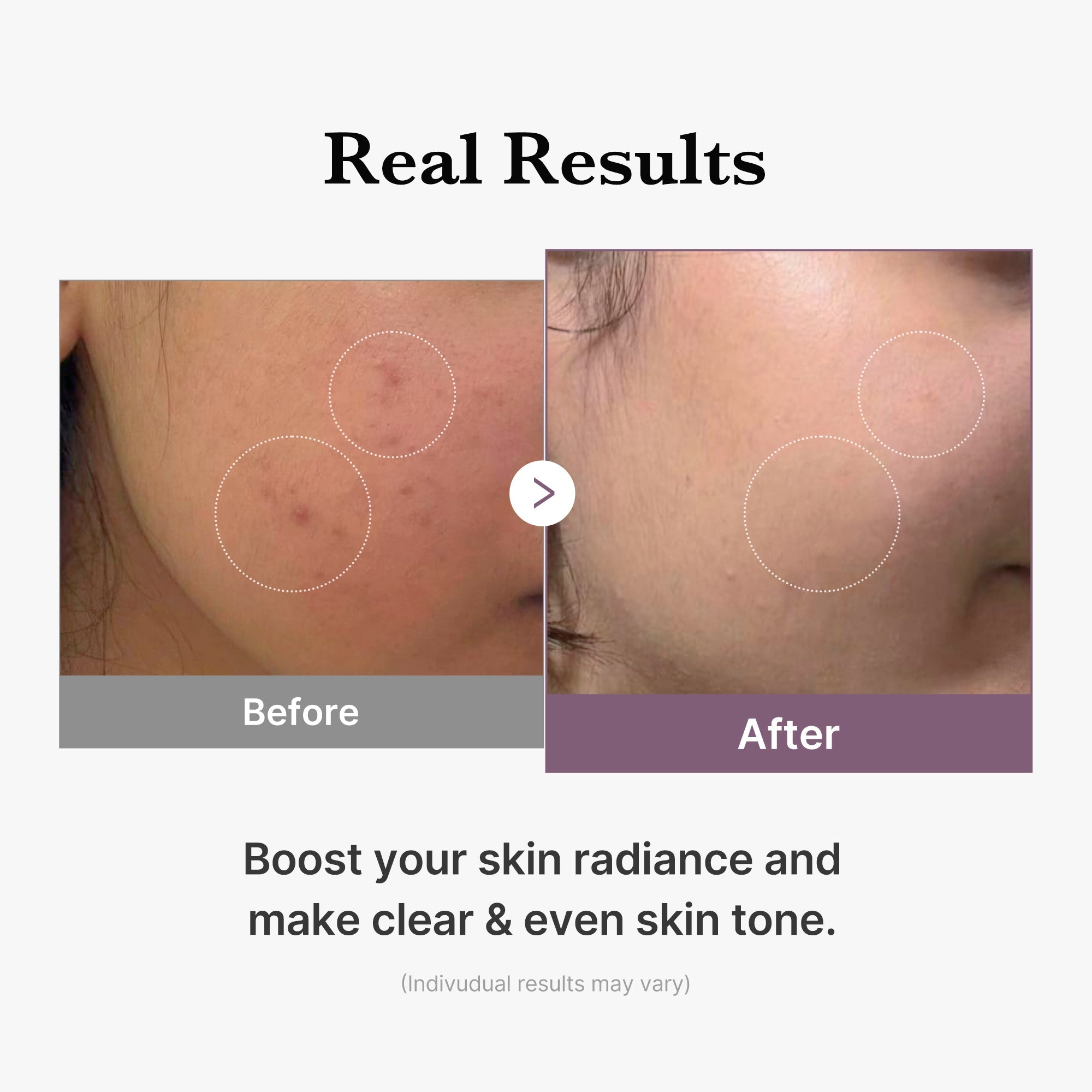 AGE-R Glutathione Glow Milk Toner in a clear bottle with a white cap, showcasing a light, milky liquid for brightening skin.