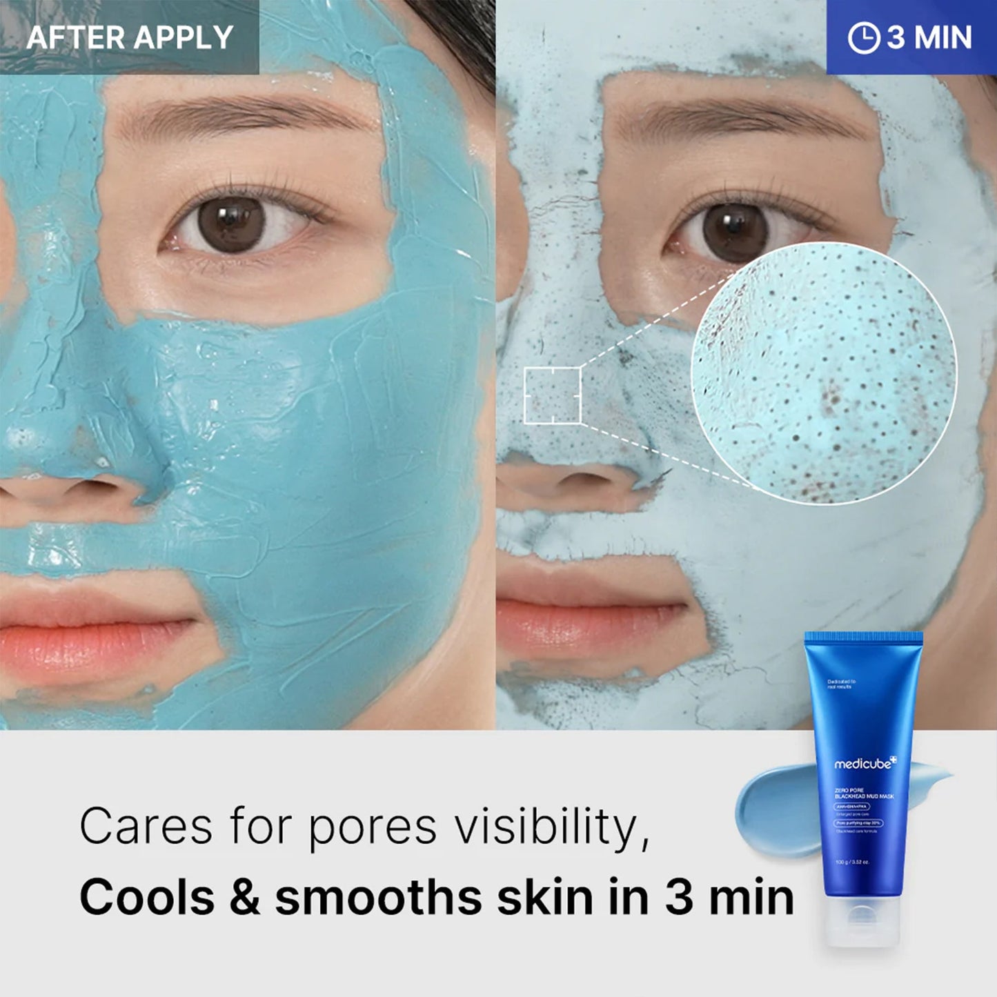 Zero Pore Blackhead Mud Mask - SKINZA