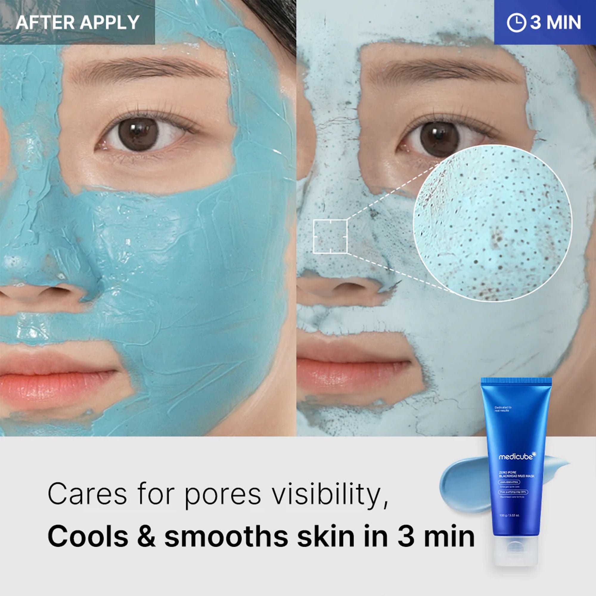Zero Pore Blackhead Mud Mask - SKINZA