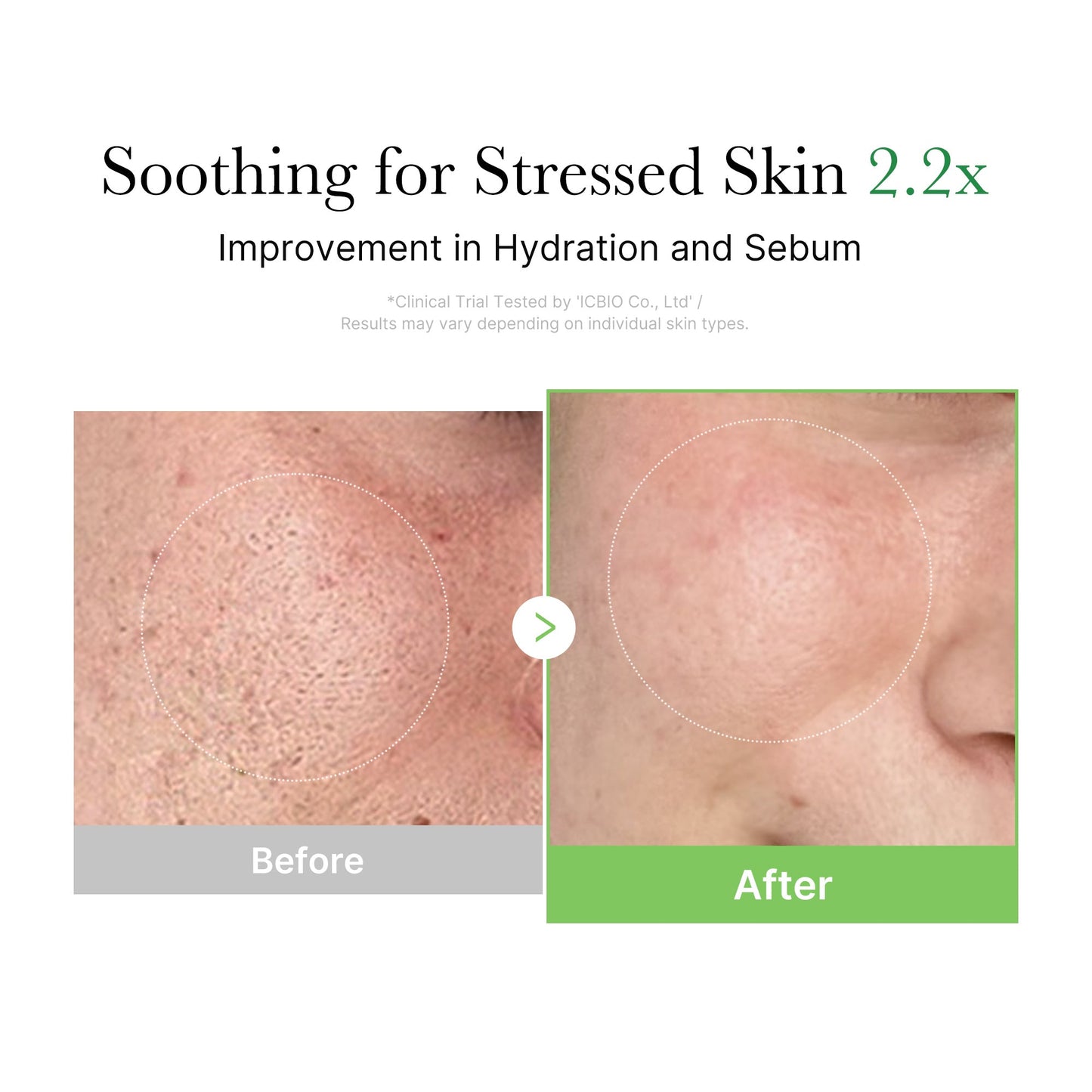 Medicube Exosome Cica Calming Cream for face, featuring soothing and hydrating skincare in a white jar with a pump dispenser.