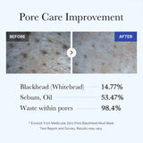 Zero Pore Blackhead Mud Mask - SKINZA