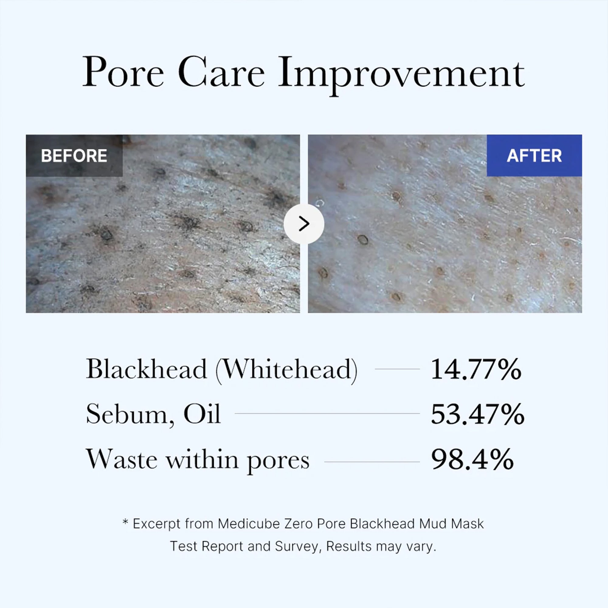 Zero Pore Blackhead Mud Mask - SKINZA