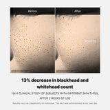 Zero Pore One-day Serum from ZERO LINE by SHOPIFY_ME, showing a clear bottle of pore care serum with applicator brush.