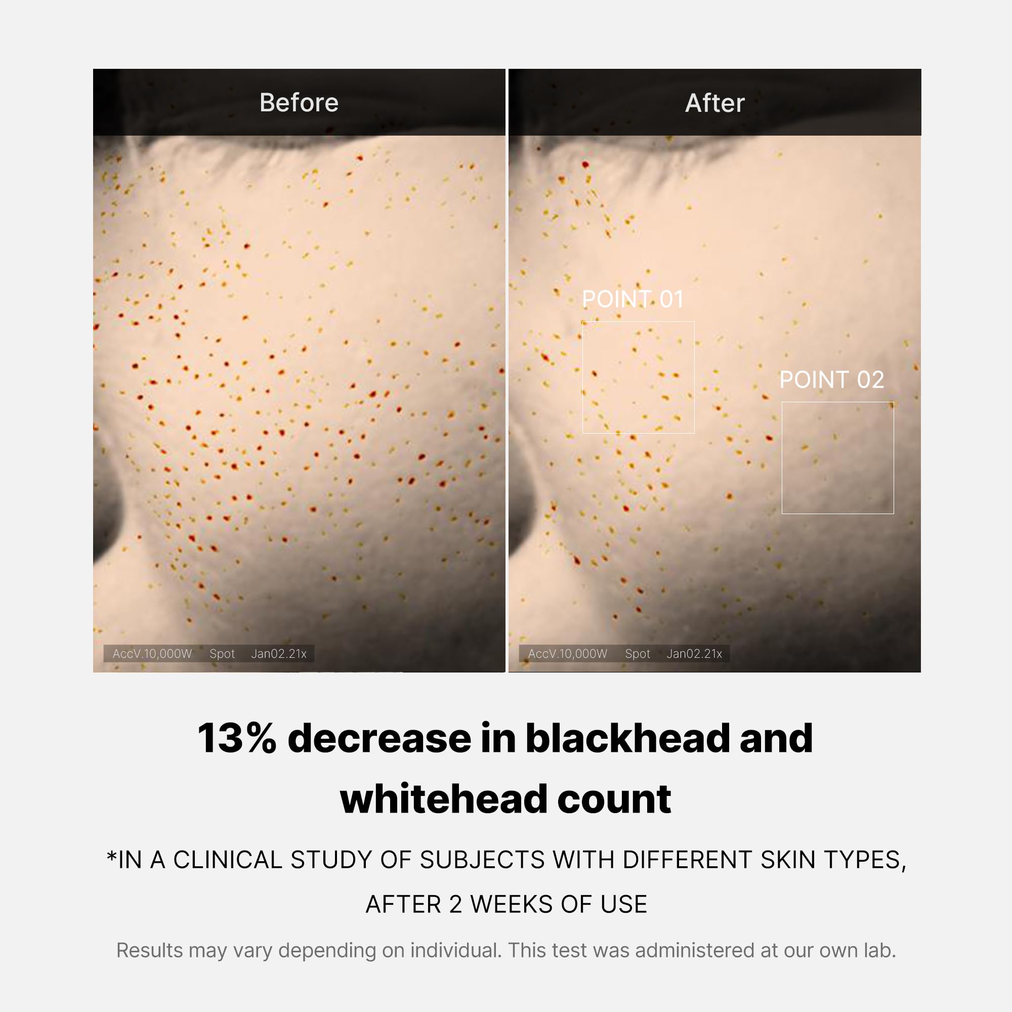 Zero Pore One-day Serum from ZERO LINE by SHOPIFY_ME, showing a clear bottle of pore care serum with applicator brush.