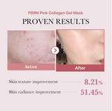 Before and after effect of PDRN Pink Collagen Gel Mask on skin texture and radiance.