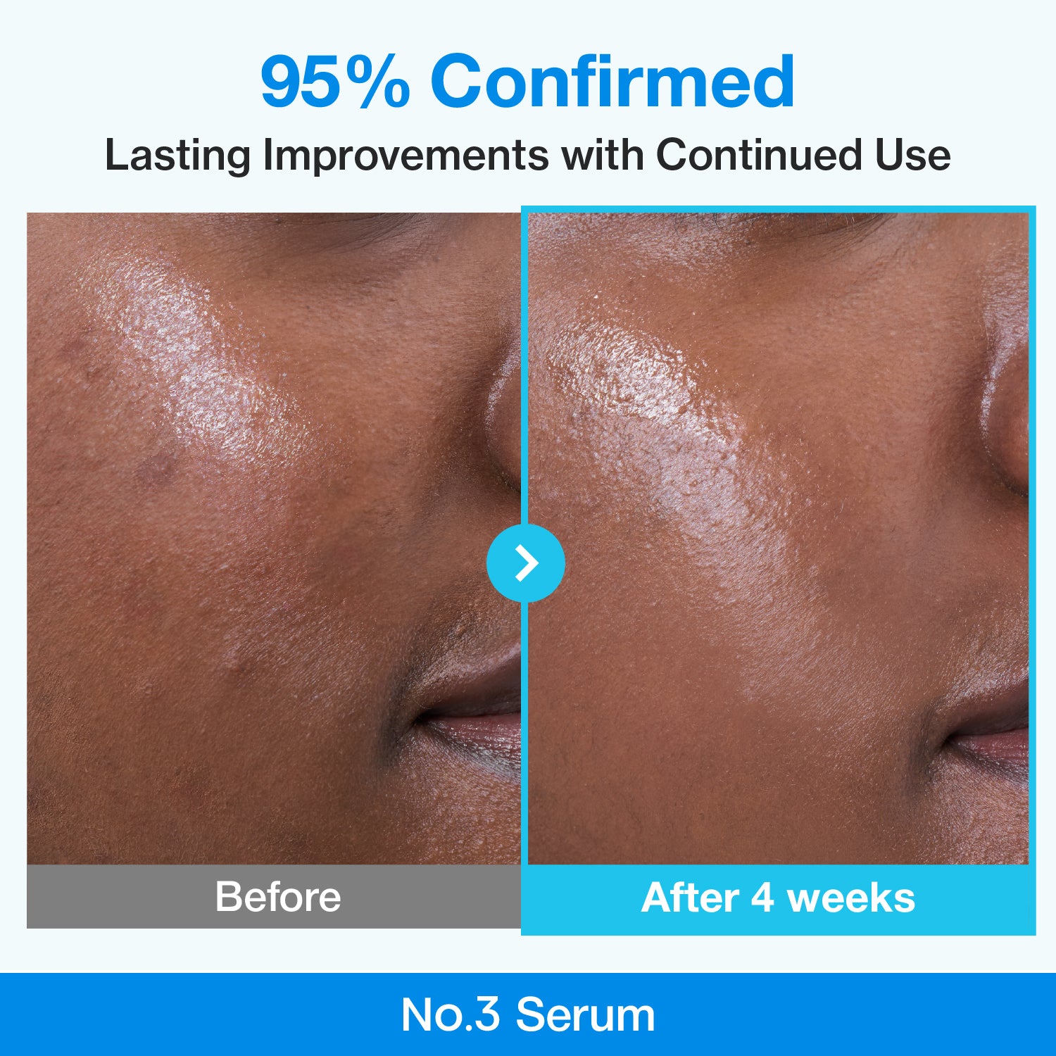 Numbuzin No.3 Blue Bio-Retinol Pore Refining Serum in a clear bottle with dropper, designed for smooth, refined skin.