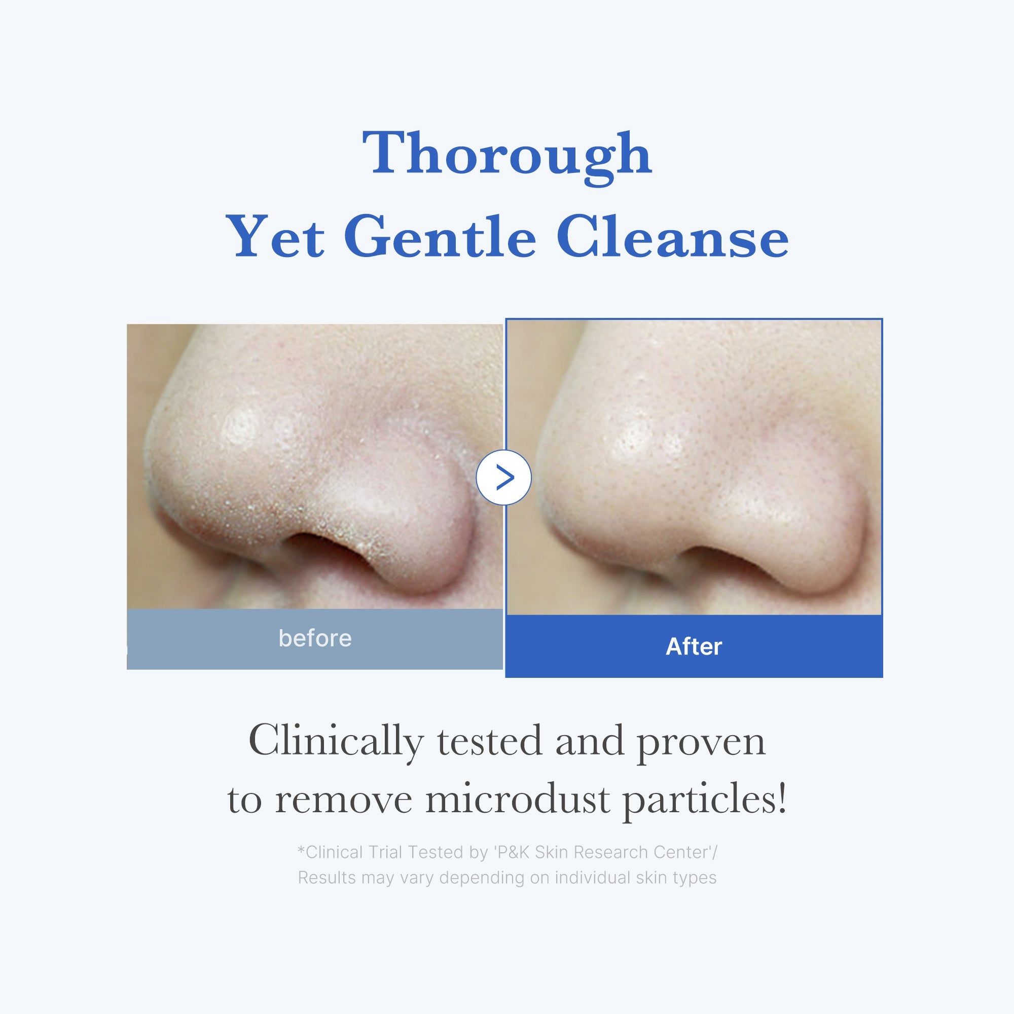 Zero Foam Cleanser from ZERO LINE by SHOPIFY_ME, showing a white bottle with a pump dispenser for pore care skincare.