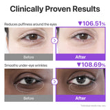 Numbuzin No.9 NAD+ Collagen Under Eye Patches in a box, designed for special eye treatment to reduce puffiness and dark circles.