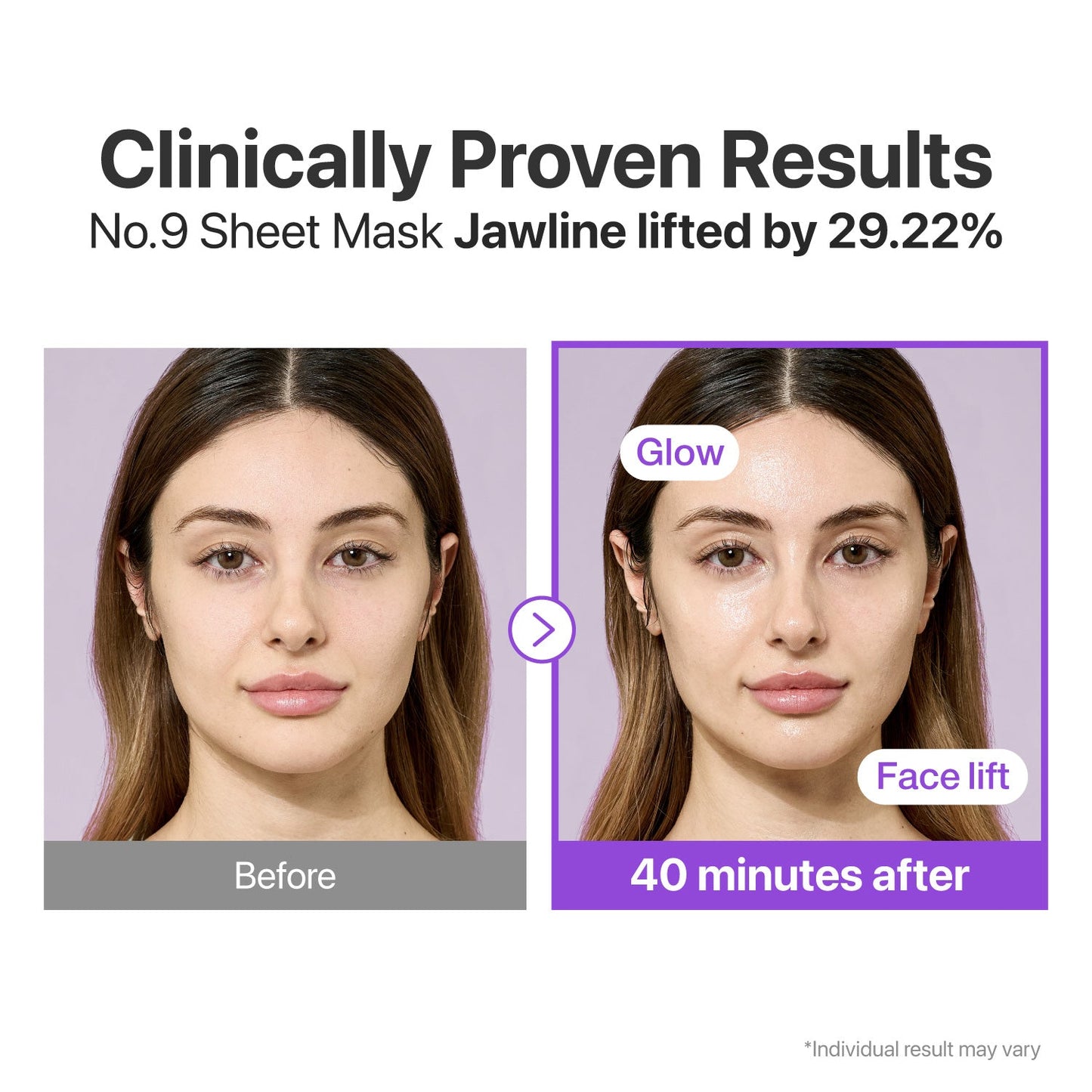 Numbuzin No.9 NAD+ BIO Lifting-sil full face sheet mask with lifting band, four sheet masks for facial rejuvenation and skin firming.