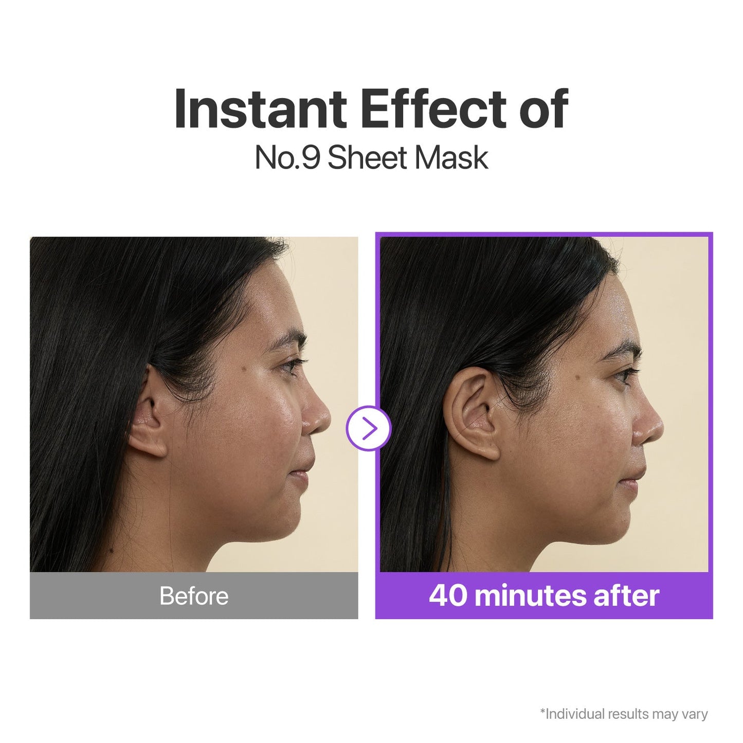 Numbuzin No.9 NAD+ BIO Lifting-sil sheet mask with lifting band, designed for full face skincare, featuring four sheet masks.
