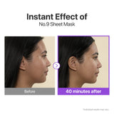 Numbuzin No.9 NAD+ BIO Lifting-sil sheet mask with lifting band, designed for full face skincare, featuring four sheet masks.