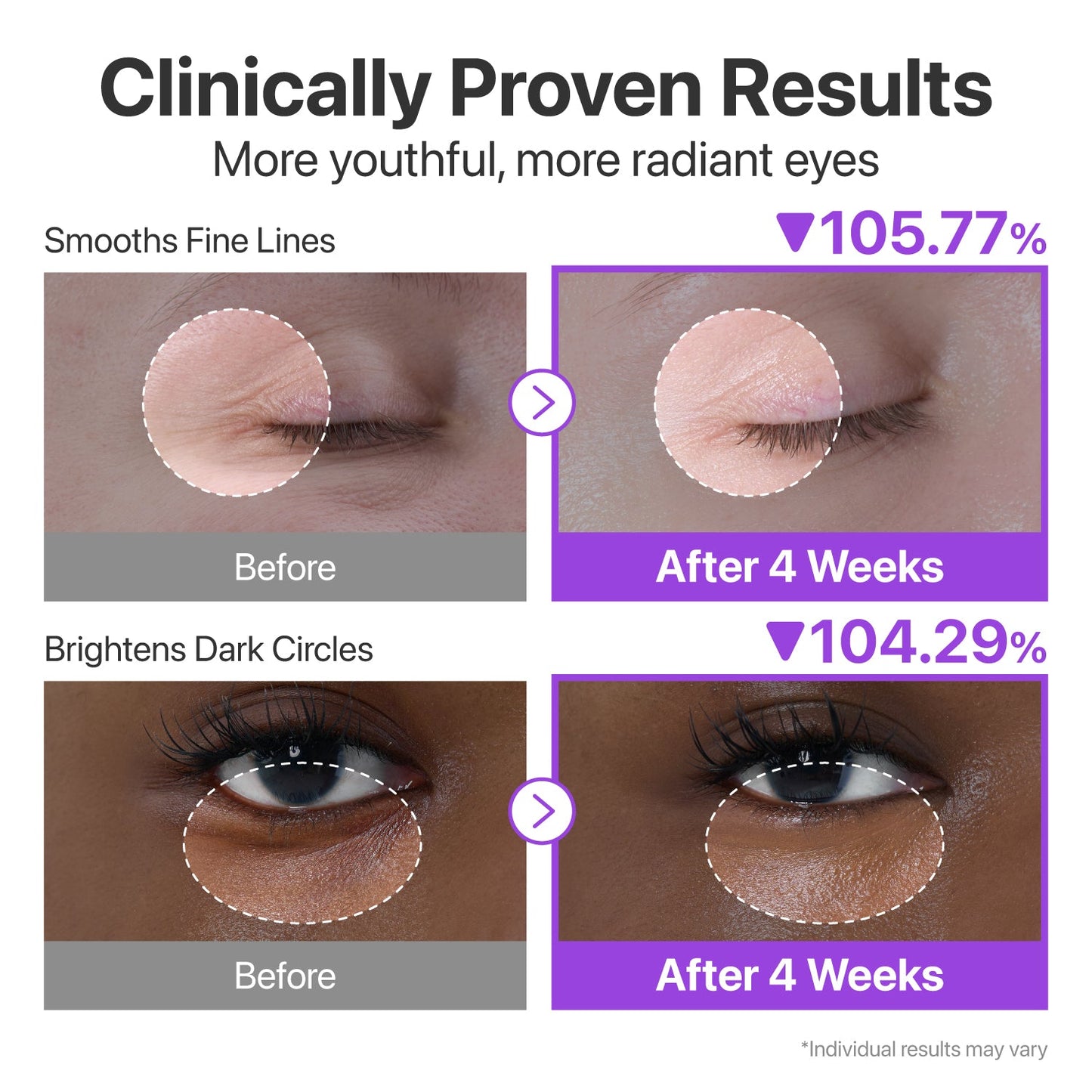 Numbuzin No.9 NAD+ Retinol Volumetox Eye Cream in a sleek jar, designed for special eye treatment to reduce puffiness and signs of aging.