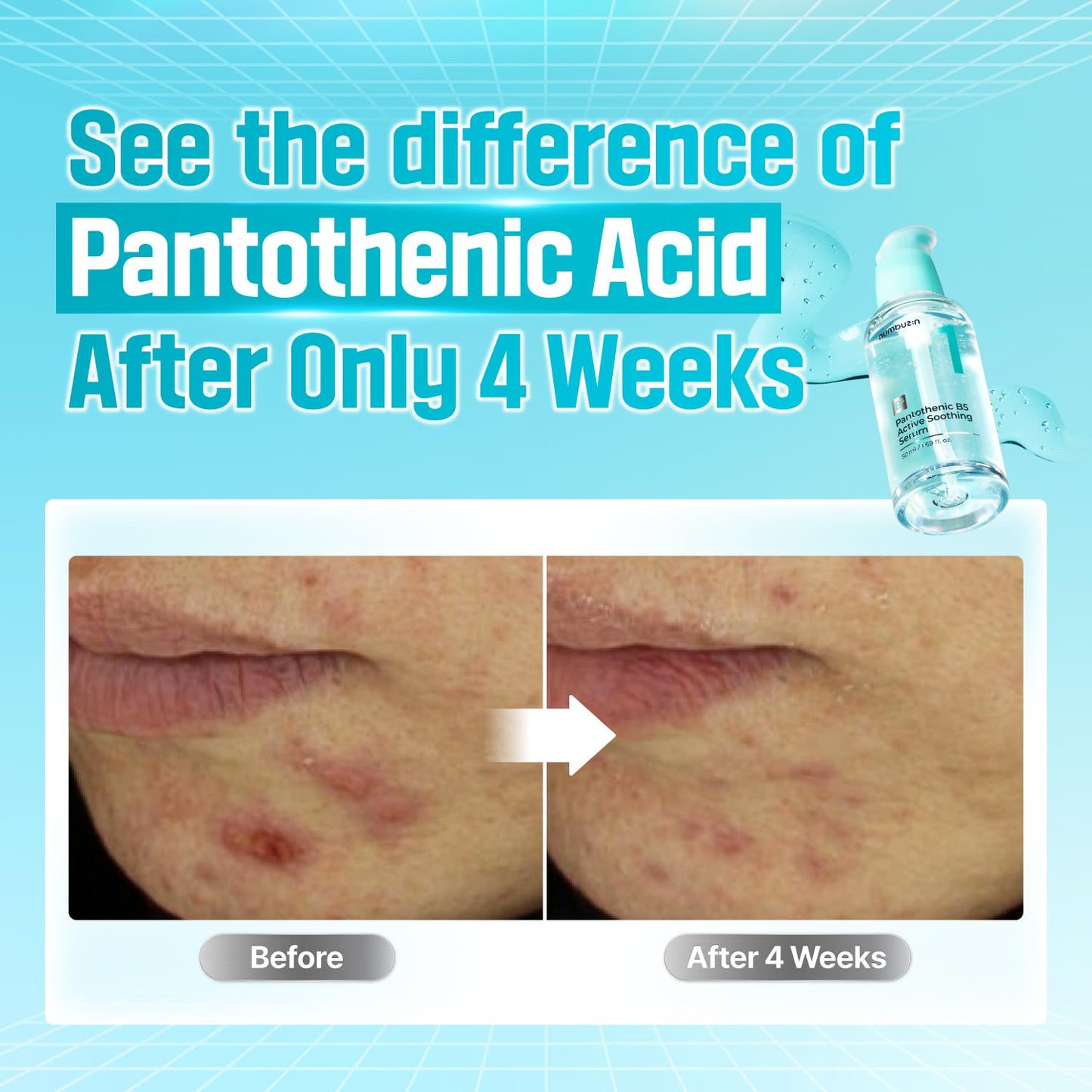 Numbuzin No.1 Pantothenic B5 Active Soothing Serum in a clear glass bottle with a dropper for calming skin application