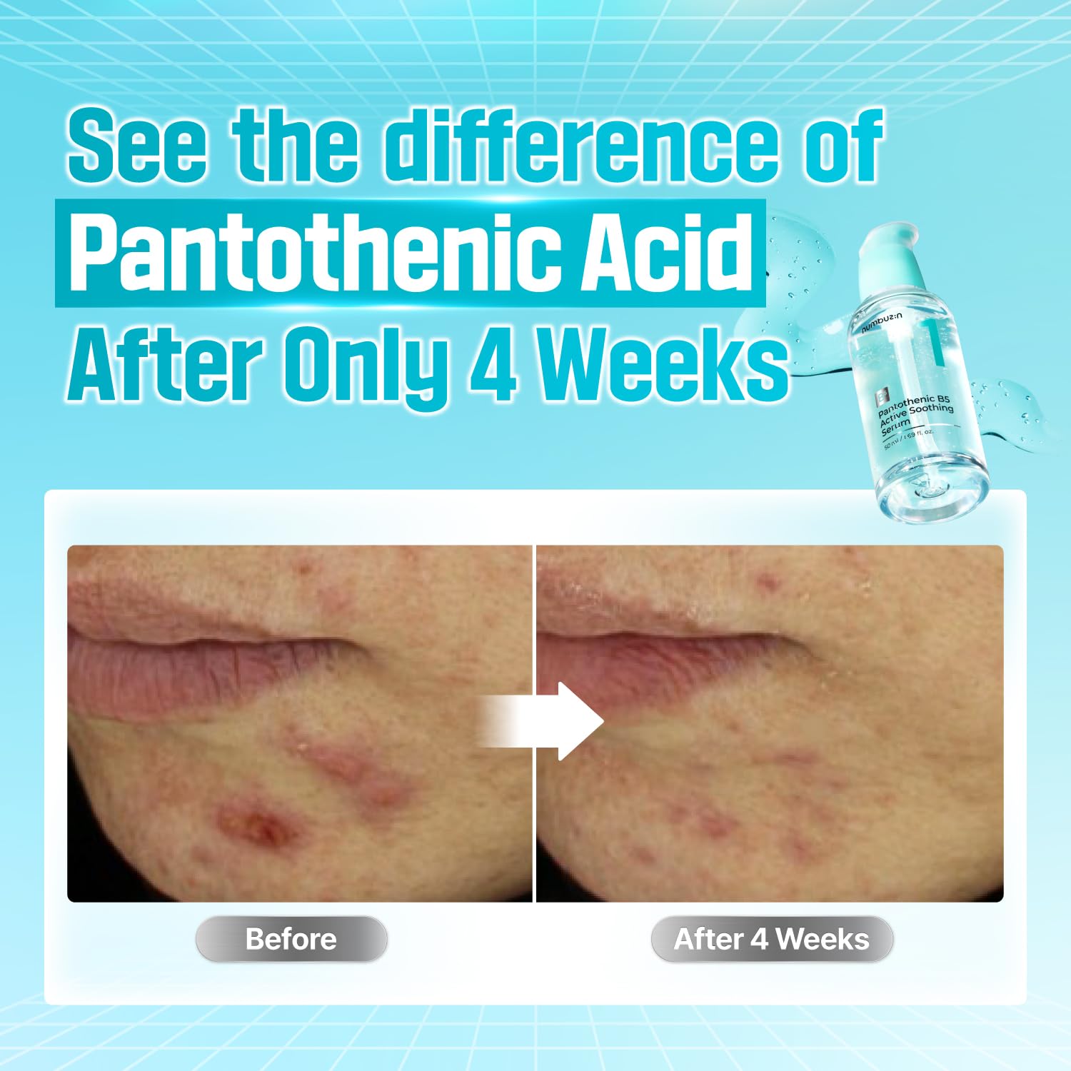 Numbuzin No.1 Pantothenic B5 Active Soothing Serum in a clear glass bottle with a dropper for calming skin application
