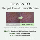 Arencia Fresh Green Rice Mochi Cleanser for face care, showing the cleanser's packaging with green rice mochi ingredients.