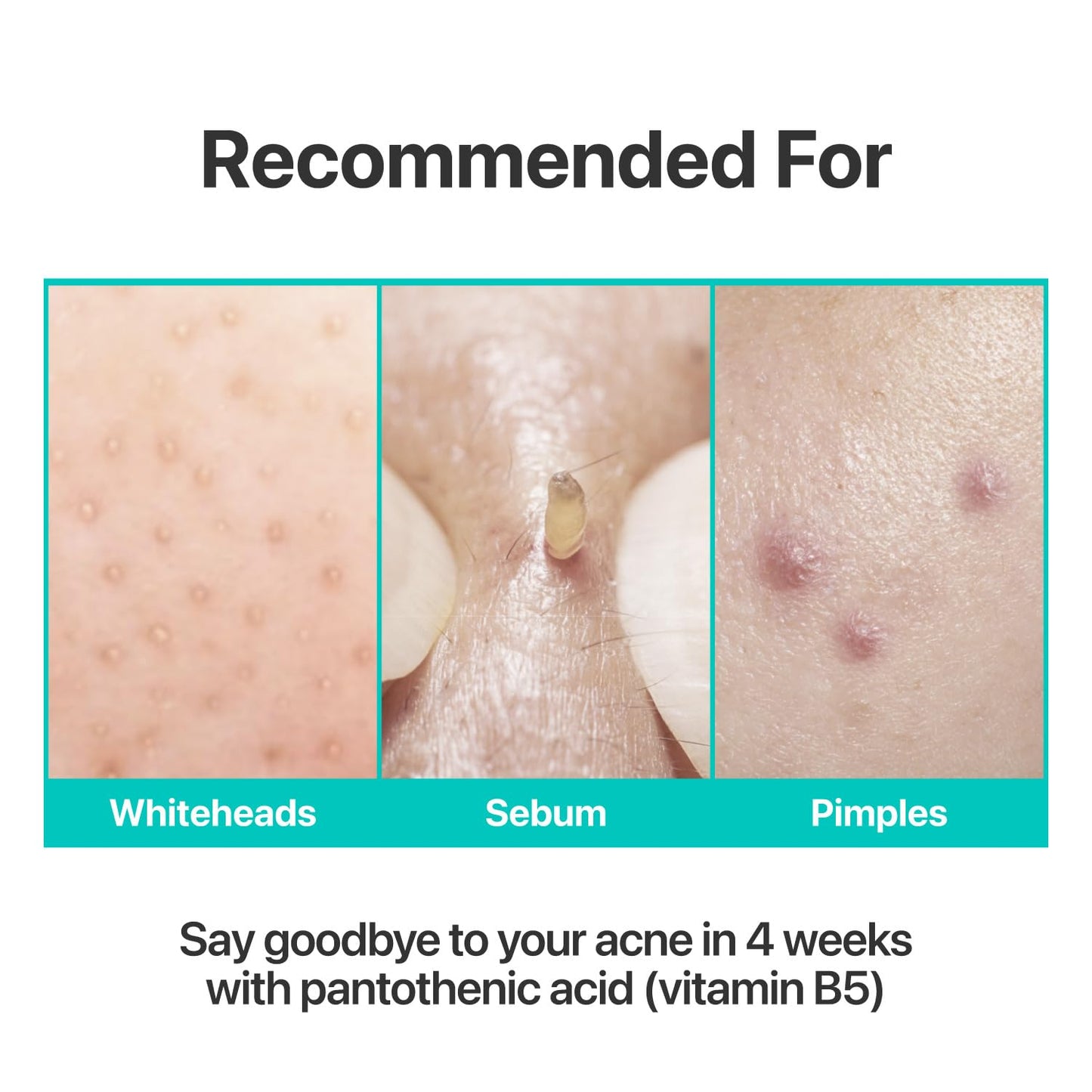 Numbuzin No.1 Cream with Pantothenic B5, a soothing cream for skin hydration and calming relief, shown in a white jar.