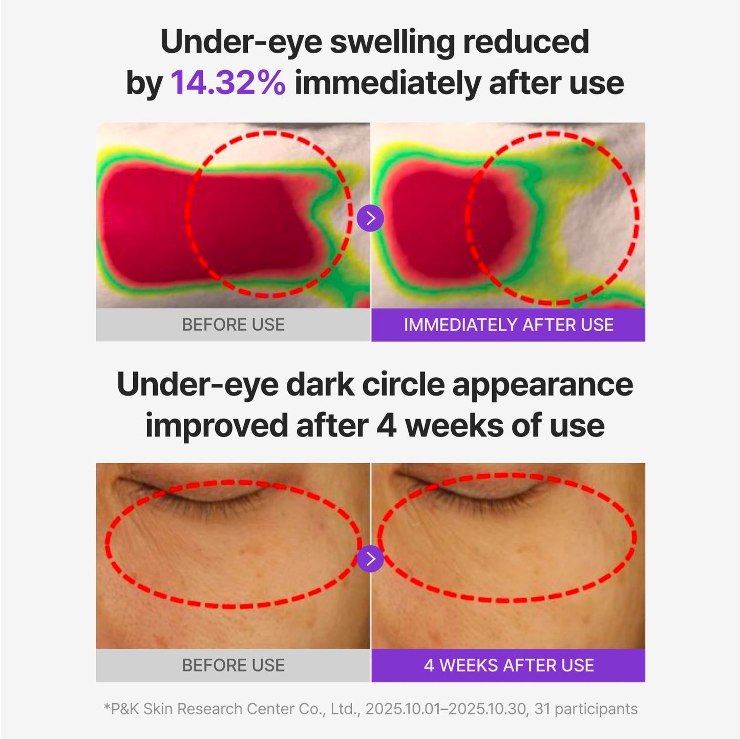 CENTELLIAN 24 PDRN Glowing Eye Patch for eye care, showing the patch applied under the eye with a soothing glow.
