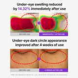CENTELLIAN 24 PDRN Glowing Eye Patch for eye care, showing the patch applied under the eye with a soothing glow.