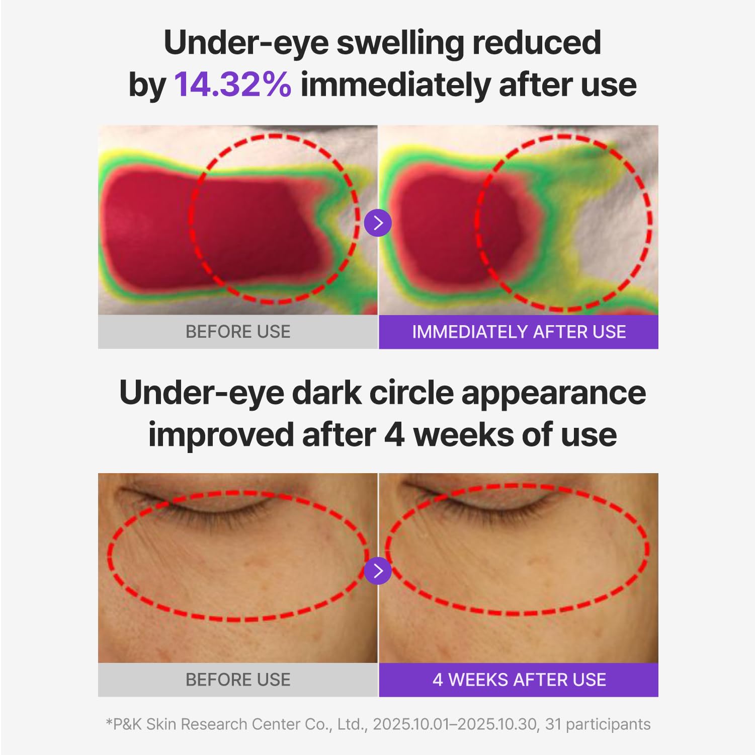 CENTELLIAN 24 PDRN Glowing Eye Patch for eye care, showing the patch applied under the eye with a soothing glow.