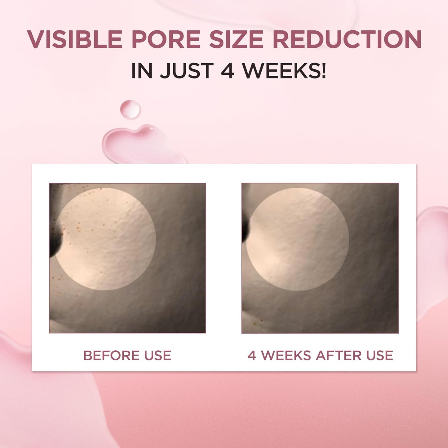 SKINZA Madagascar Centella Pore-Minizing Fresh Ampoule in clear glass bottle with dropper for skincare.