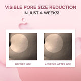 SKINZA Madagascar Centella Pore-Minizing Fresh Ampoule in clear glass bottle with dropper for skincare.