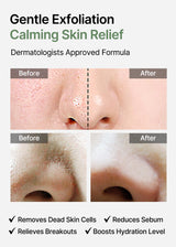 Celimax Ji.Woo.Gae Heartleaf BHA Peeling Pad showing a stack of facial exfoliating pads with brand packaging.