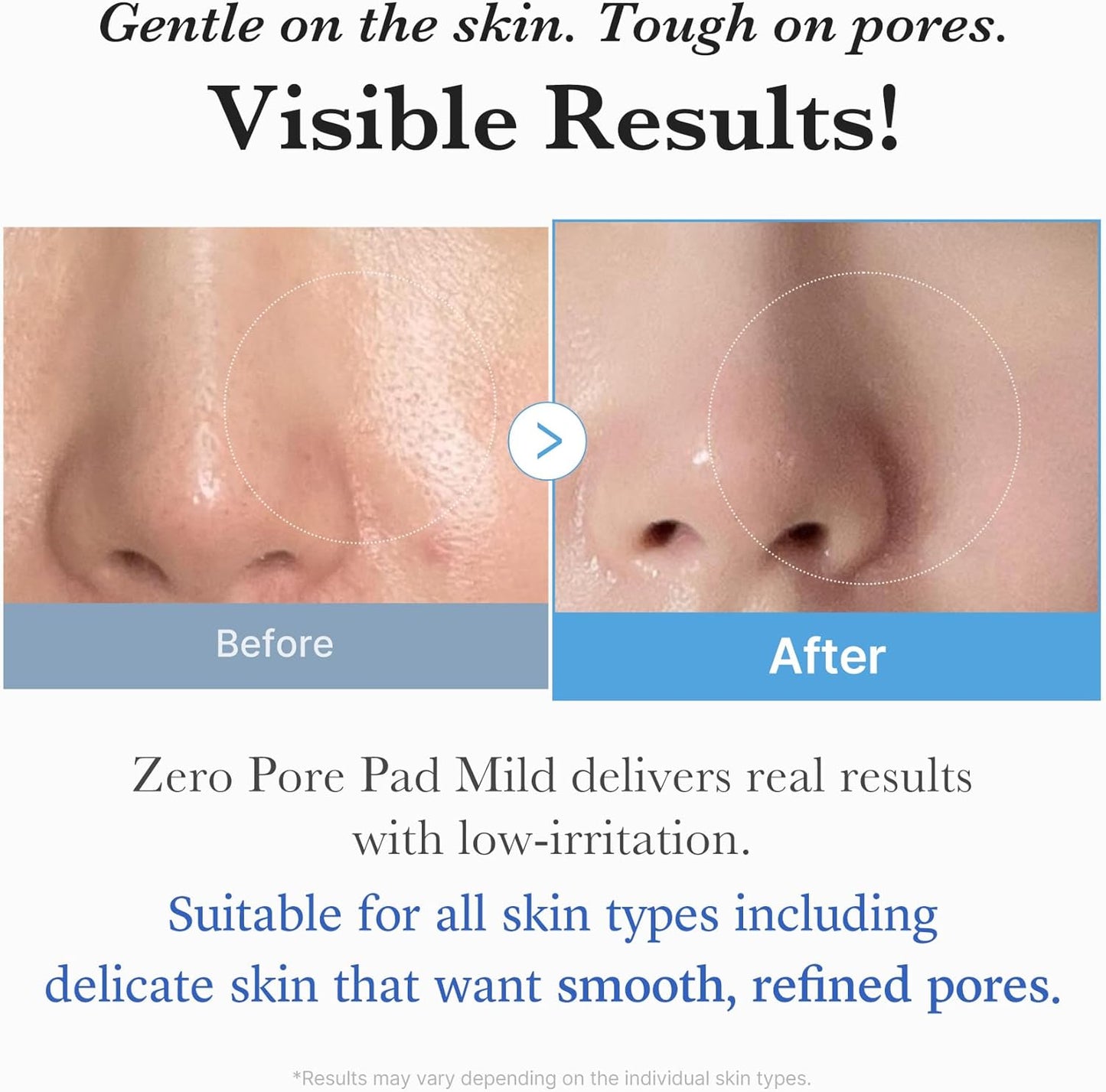 Medicube Zero Pore Pads from the ZERO LINE for pore care, showing the packaging with the product inside.