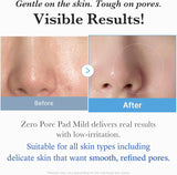 Medicube Zero Pore Pads from the ZERO LINE for pore care, showing the packaging with the product inside.