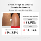 Medicube Body Peel Shot with hypochlorous acids, showcasing the body care product in a sleek bottle with a white cap.