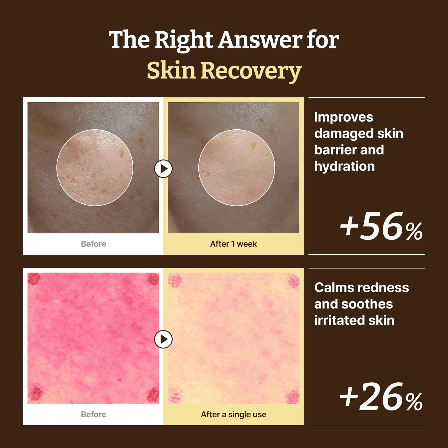 Dr.Reju-All anti-aging cream routine set with multiple skincare products in sleek packaging for youthful skin.
