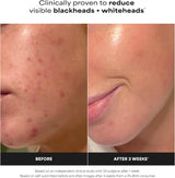 SKINZA Paula’s Choice Skin Perfecting 2% BHA Liquid Exfoliant bottle with white label and black cap on a plain background