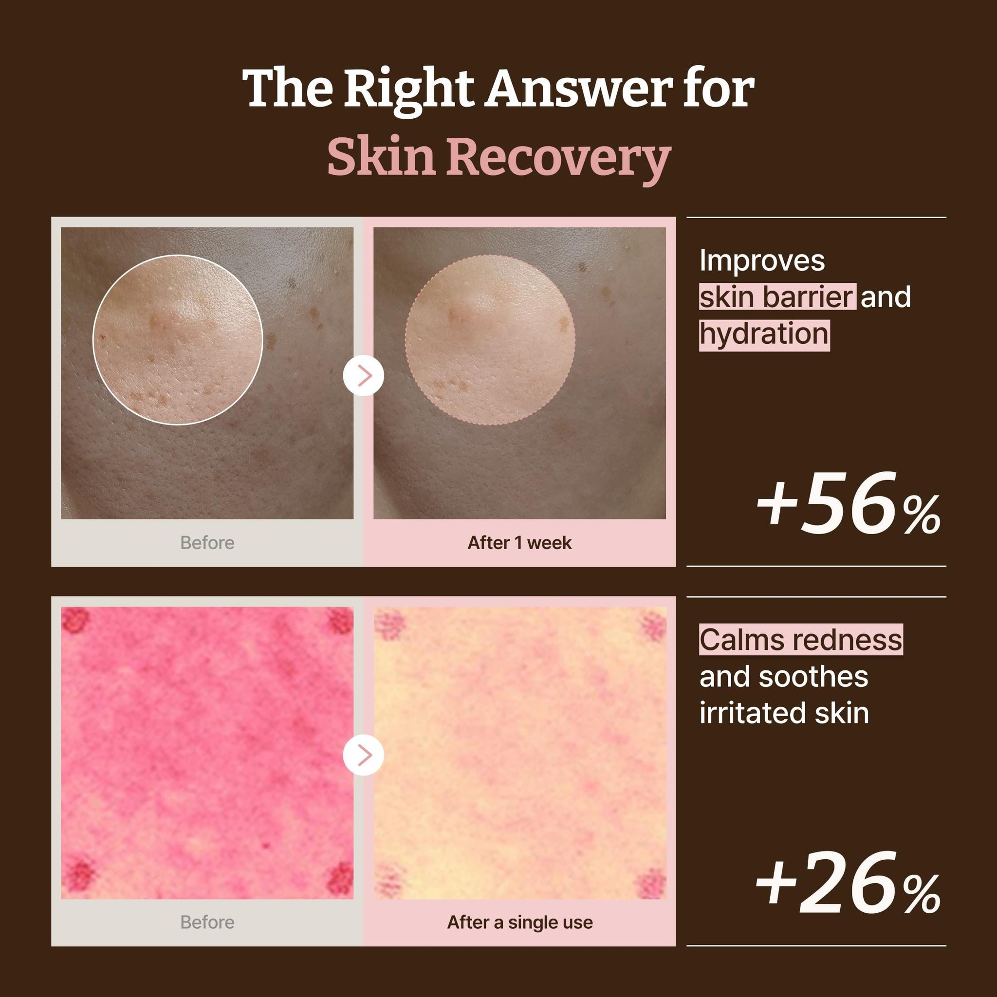 SKINZA Dr.Reju-All Advanced PDRN Rejuvenating Cream in a jar, showcasing the creamy skincare product for skin renewal and revitalization.