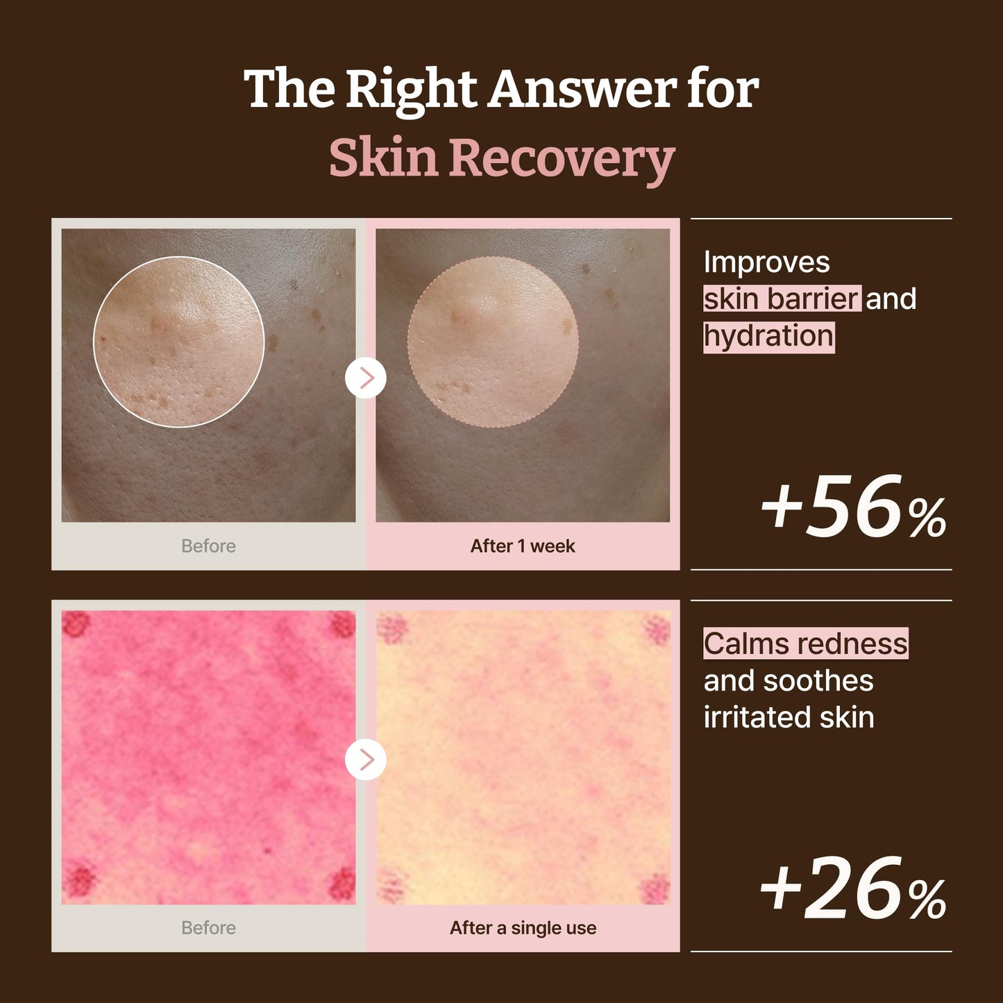 Dr.Reju-All Advanced PDRN Rejuvenating Cream with 99% pure salmon DNA gel, featuring a smooth cream texture in a jar.