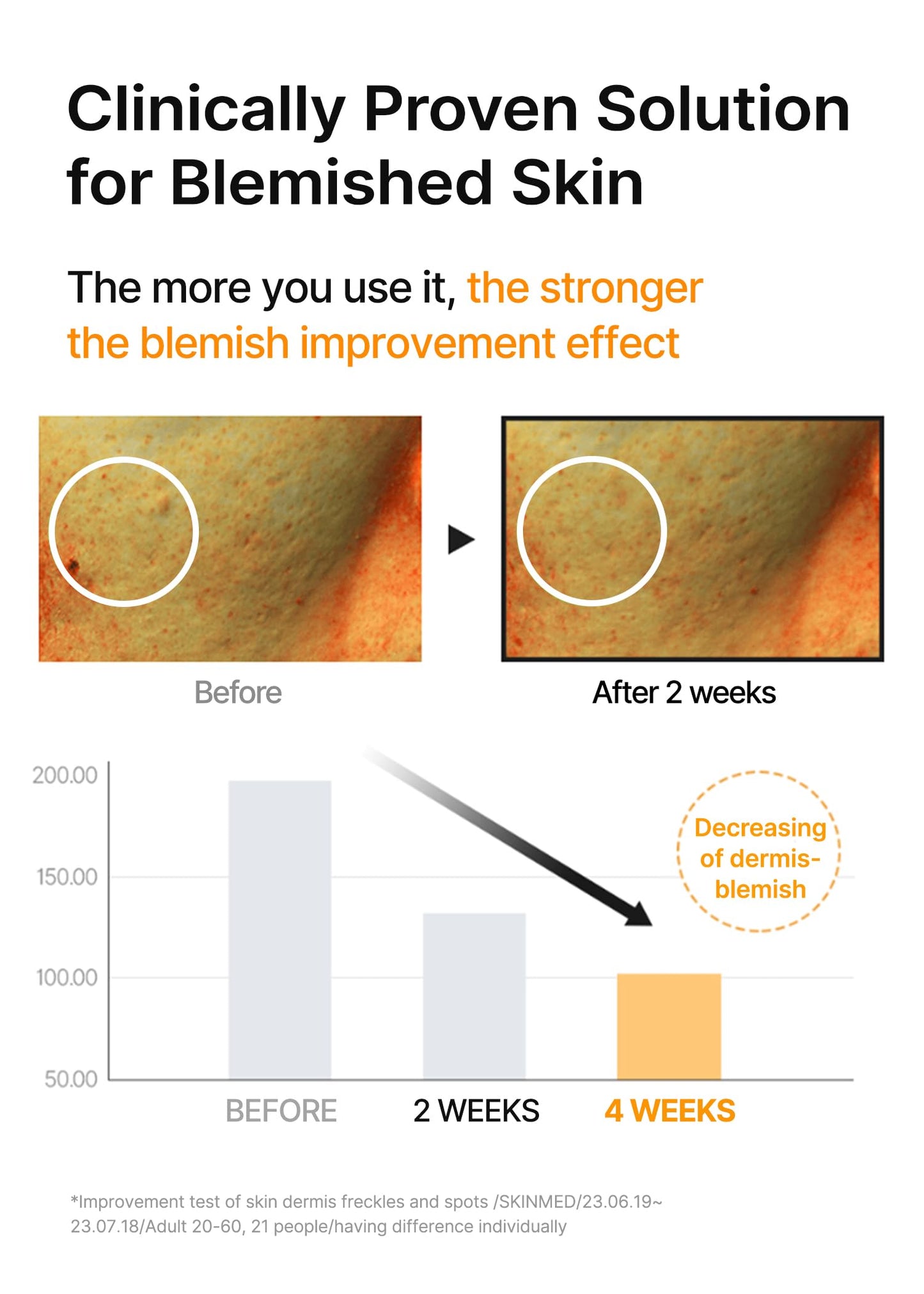 Celimax Pore Dark Spot Brightening Serum Gel in a clear tube with a pump dispenser, showing its smooth gel texture.