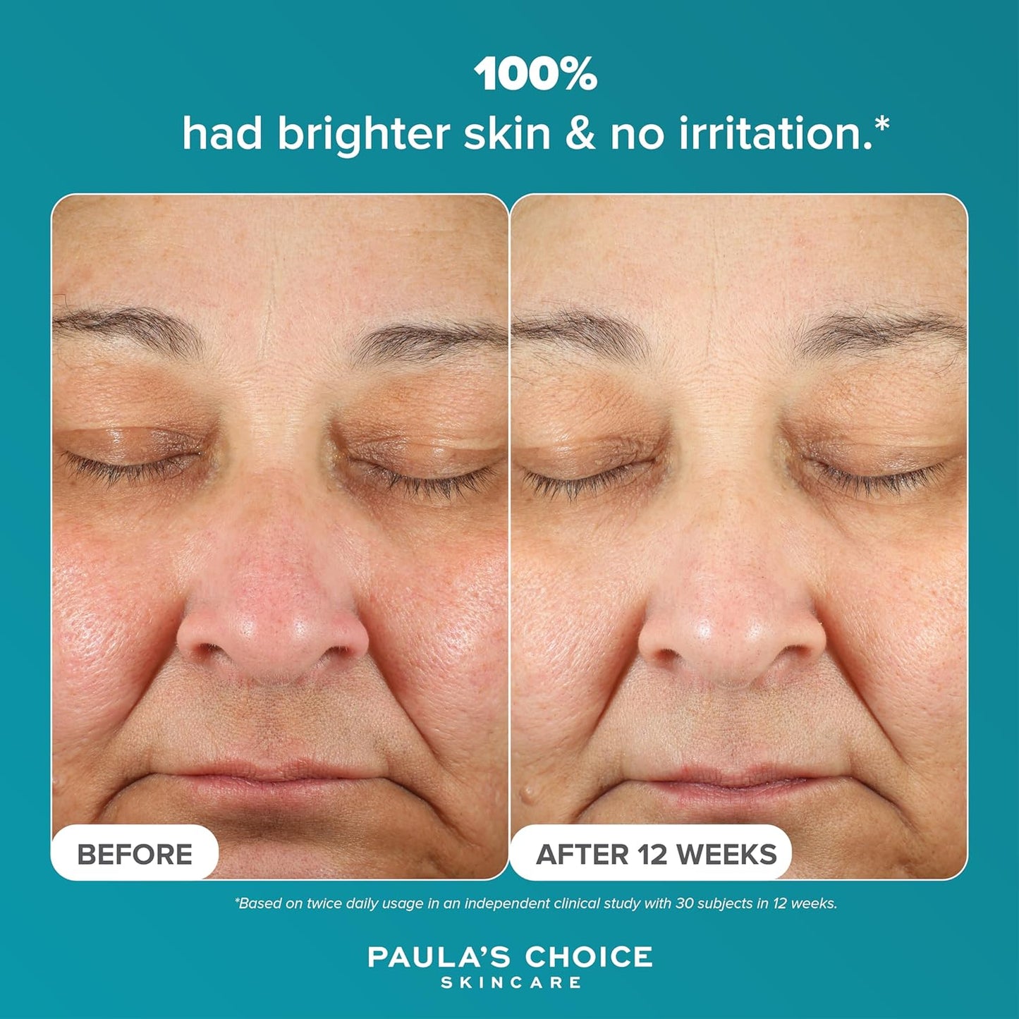 SKINZA Paula's Choice C15 Super Booster serum bottle with dropper, featuring vibrant orange liquid for skin brightening and antioxidant benefits