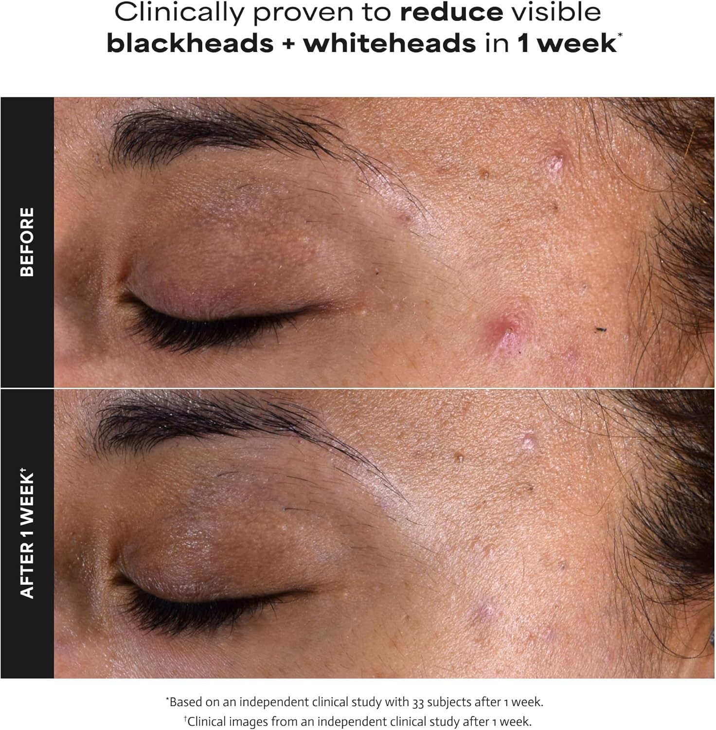 SKINZA Paula’s Choice Skin Perfecting 2% BHA Liquid Exfoliant bottle with label and pump for clear, smooth skin care.
