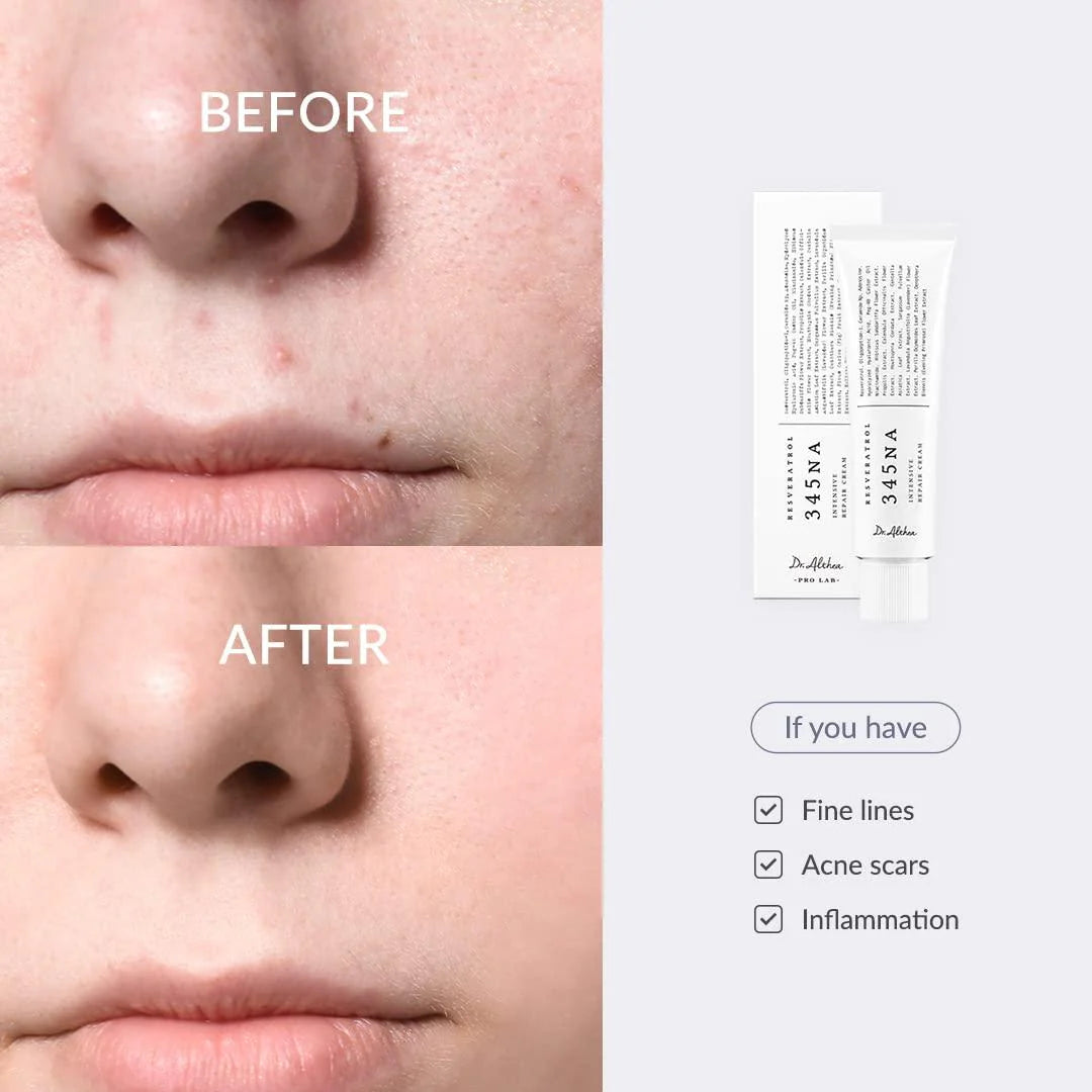 Dr. Althea 345 Relief Cream tube showing the product packaging and label for soothing skin relief by Doctoralthea.