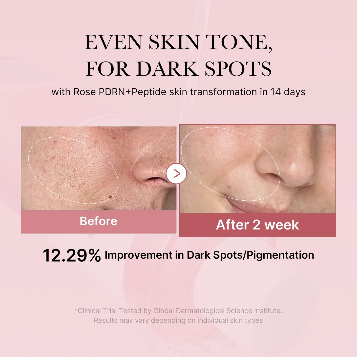 Pink PDRN line peptide toner bottle with label, featuring a sleek pink design and clear branding on a white background.