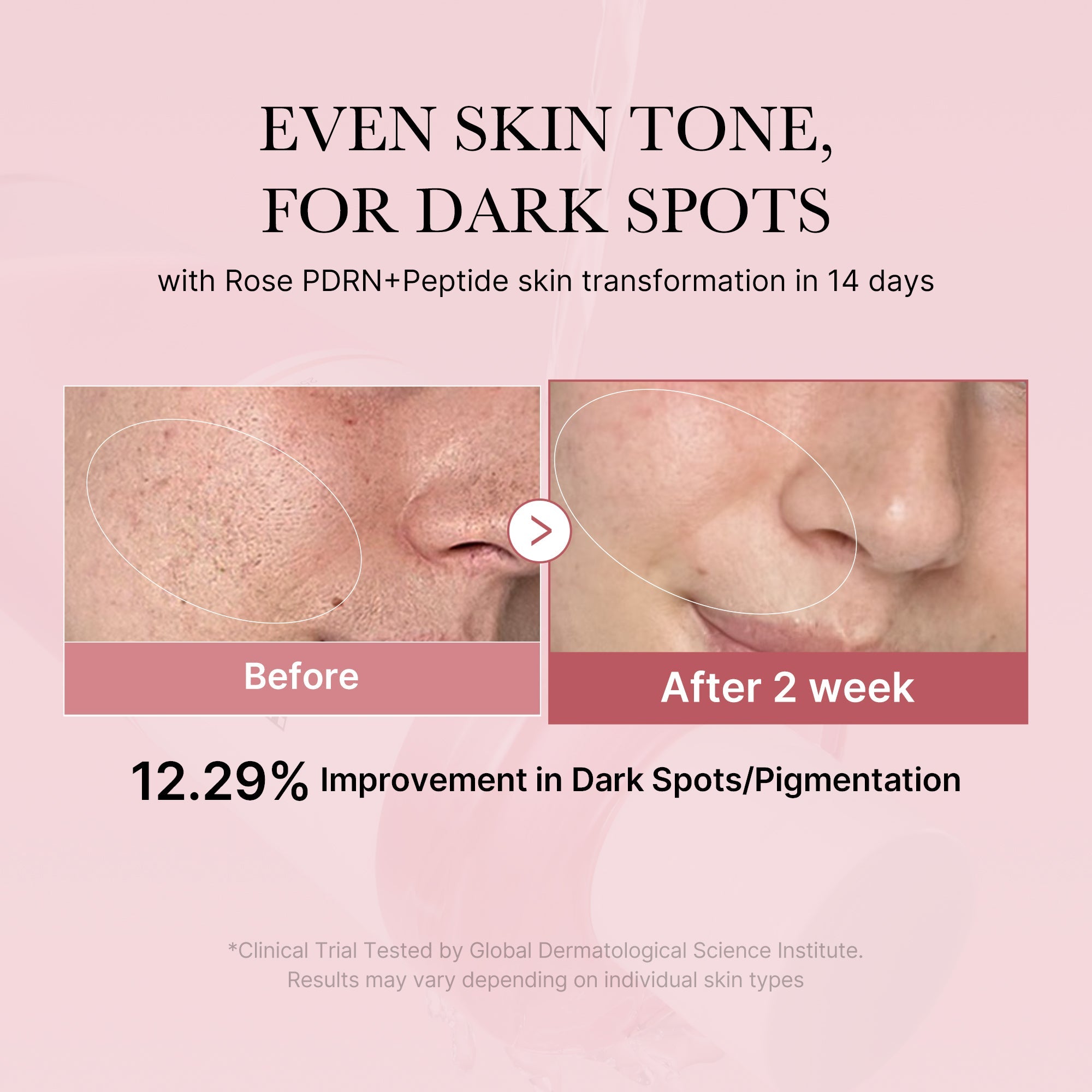 Pink PDRN line peptide toner bottle with label, featuring a sleek pink design and clear branding on a white background.