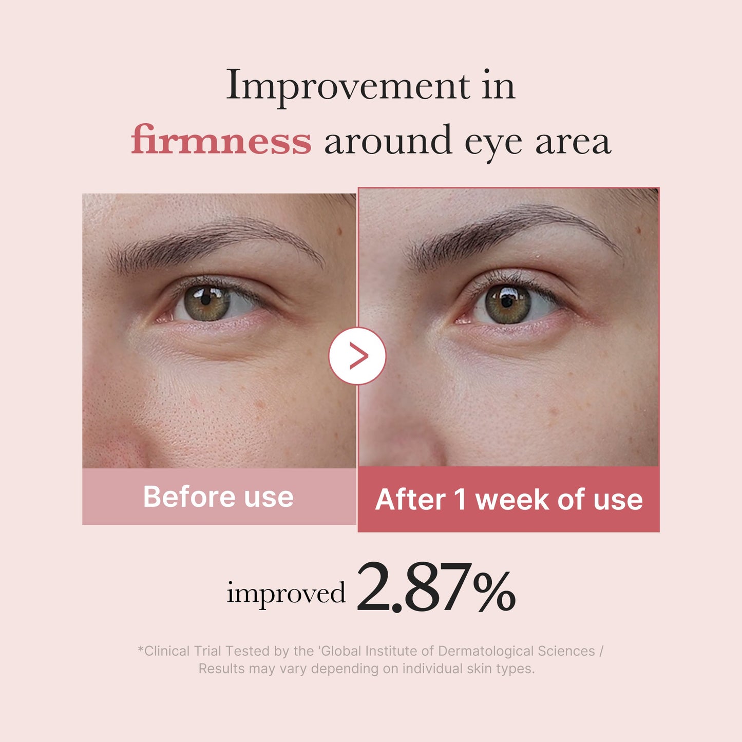 PDRN Pink Peptide Eye Cream - SKINZA