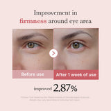 PDRN Pink Peptide Eye Cream - SKINZA